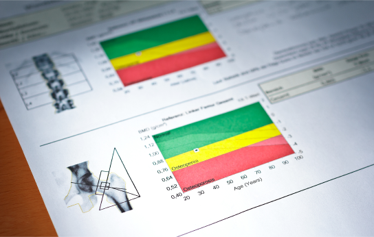 The Importance of DEXA Scan in Monitoring Bone Health