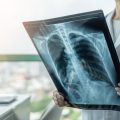 What Are X-rays?